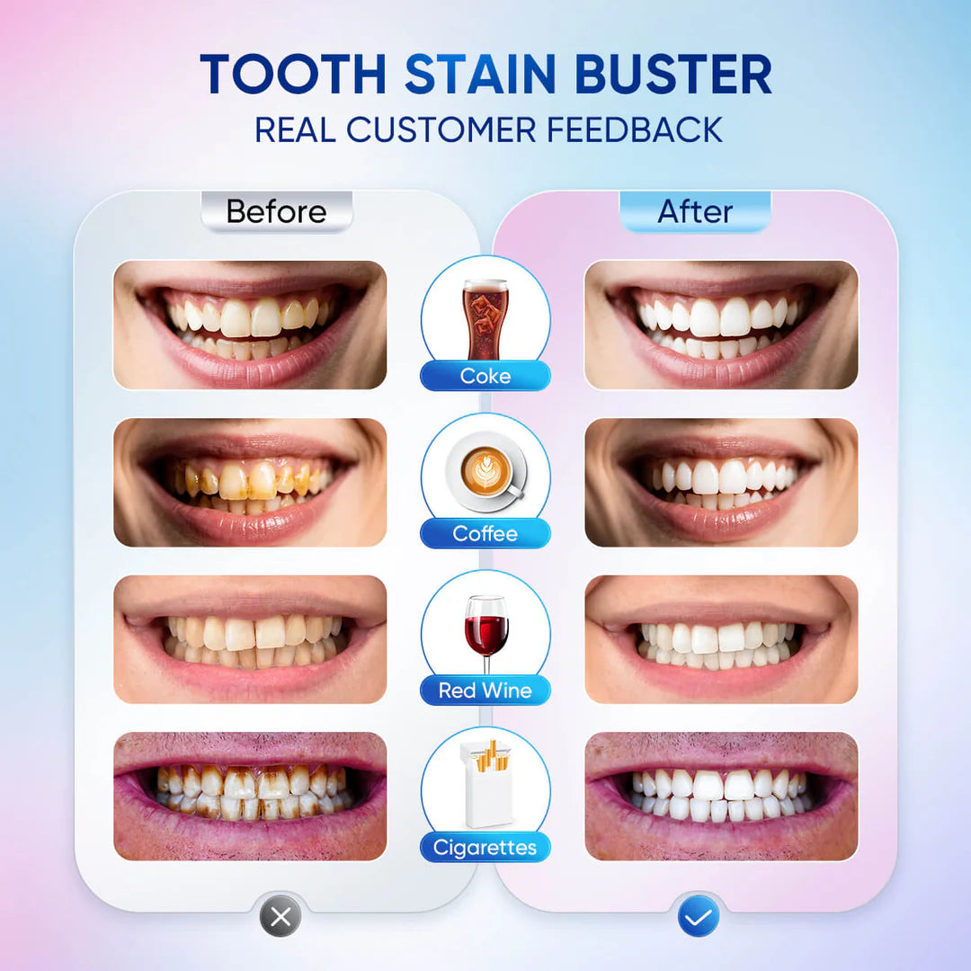 Niacinamide Whitening Toothpaste Remove Plaque Stains Reduces Plaque Teeth Oral Hygiene Clean Fresh Breath Toothpaste Teeth Care